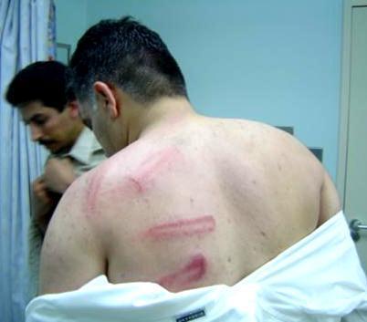 Cette photo, disponible sur Wikipedia anglais, présente les brutalités policières que Nabil Rajab aurait subies, déjà lors d'une manifestation le 15 juillet 2005.